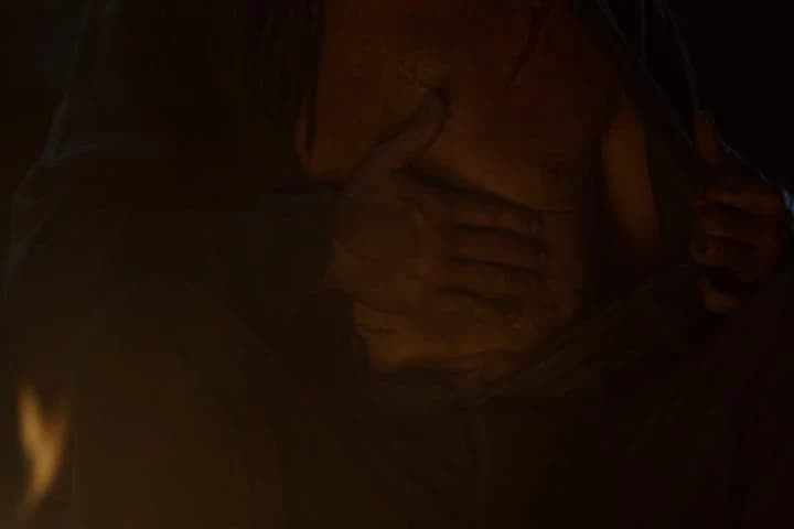 Then it was an arrow in the back.